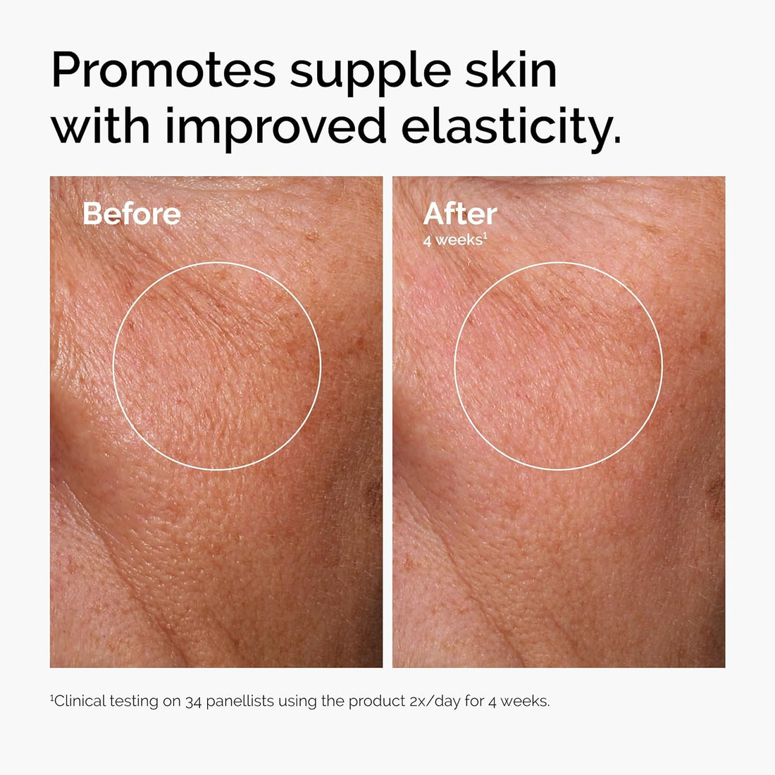 The Ordinary Hyaluronic Acid 2% + B5 30ml